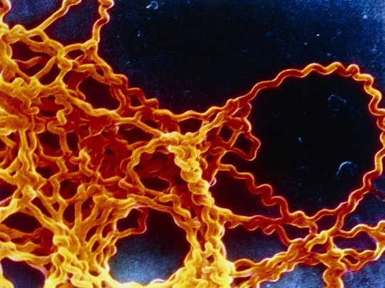 leptospira-2