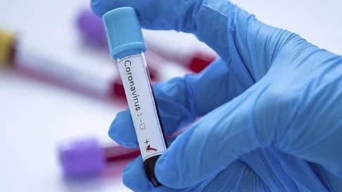 eeb7f87-coronavirus2_16x9